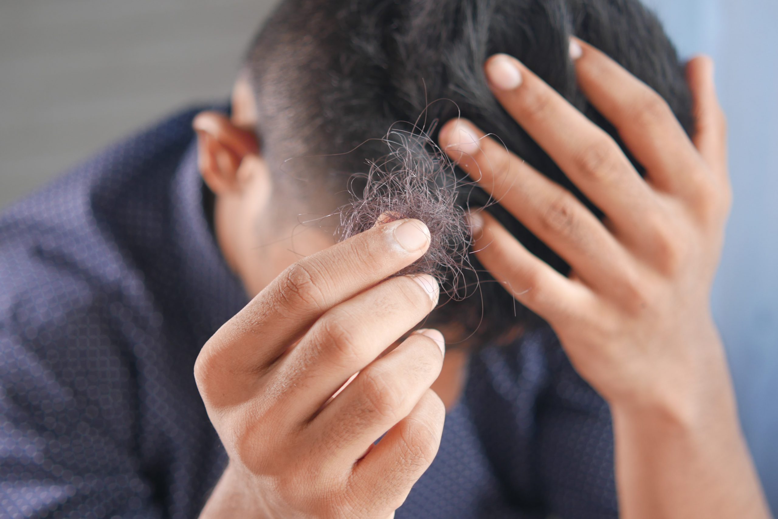Grijze haren voorkomen voor mannen – 5 handige tips
